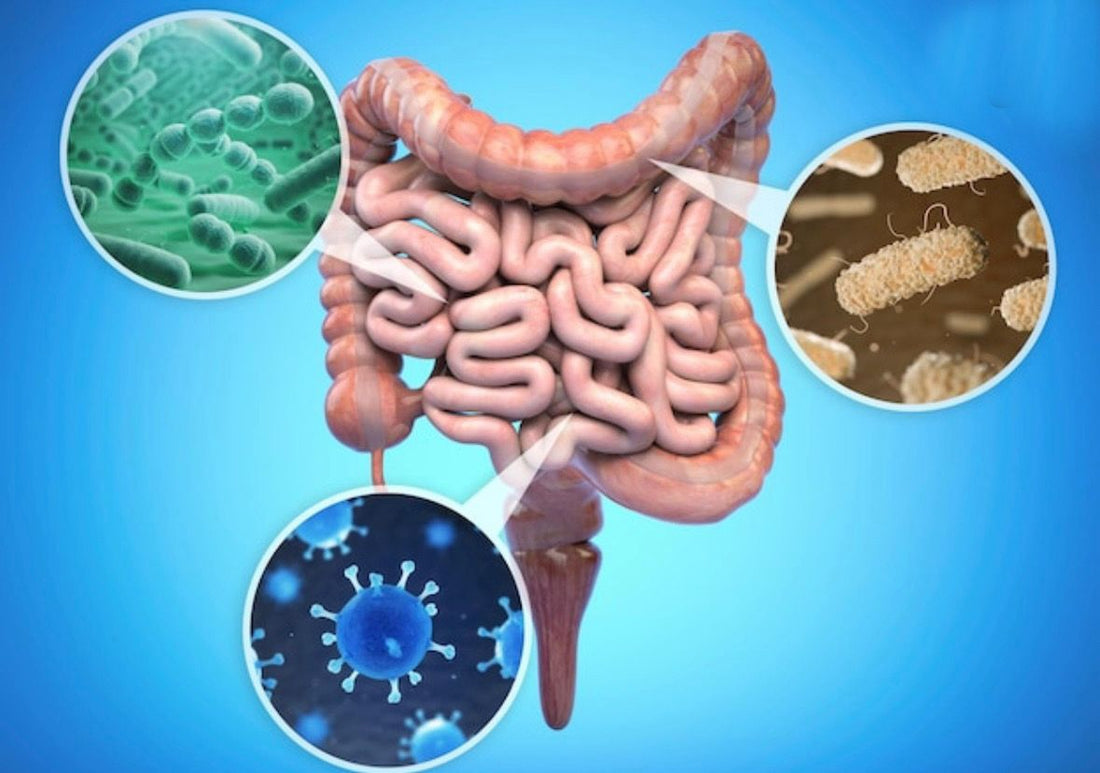 Alimentos que matan de hambre a los parásitos del intestino