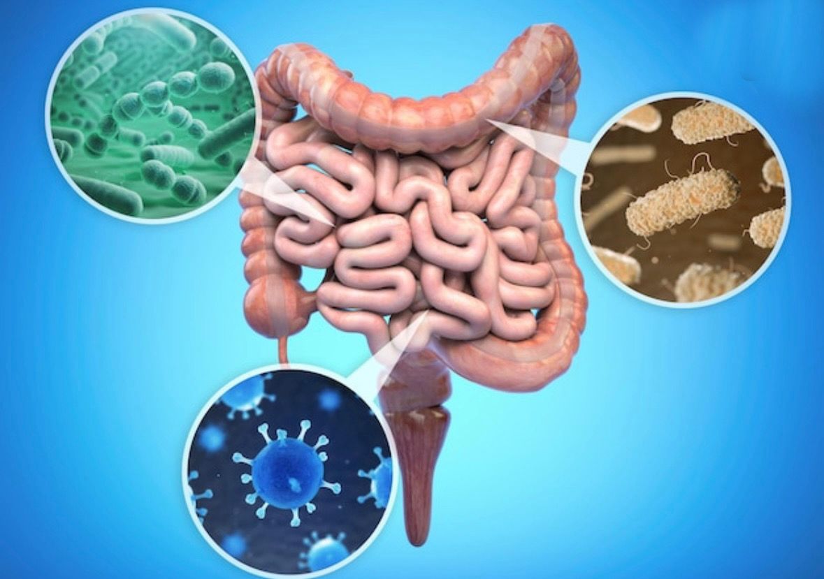 Alimentos que matan de hambre a los parásitos del intestino